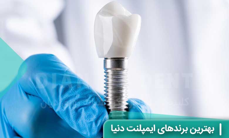 بهترین برندهای ایمپلنتهای دندانی