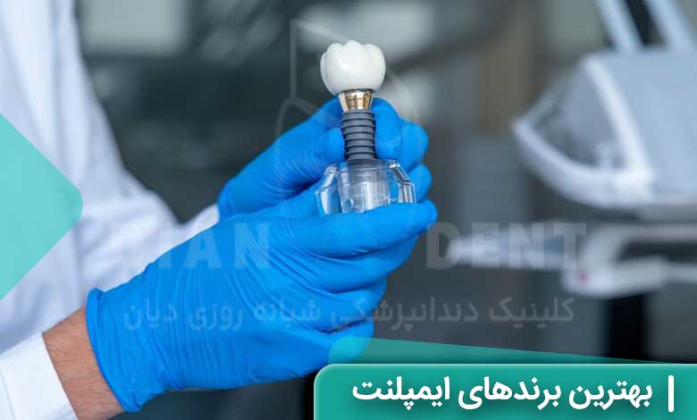 بهترین برند ایمپلنت دندان کدام است؟