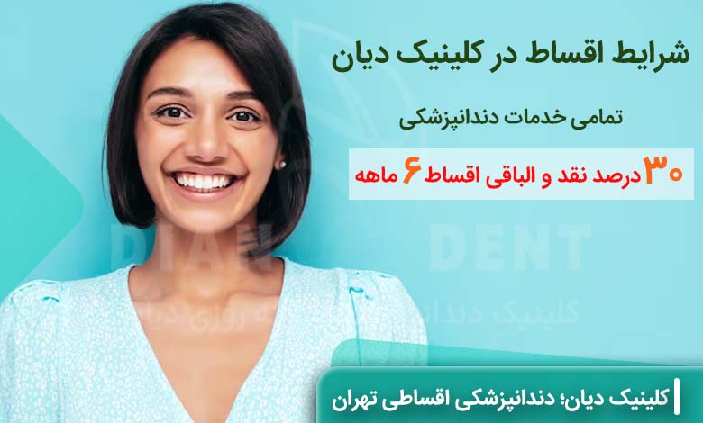 شرایط دندانپزشکی اقساط در کلینیک دیان