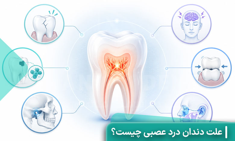 علت دندان درد عصبی