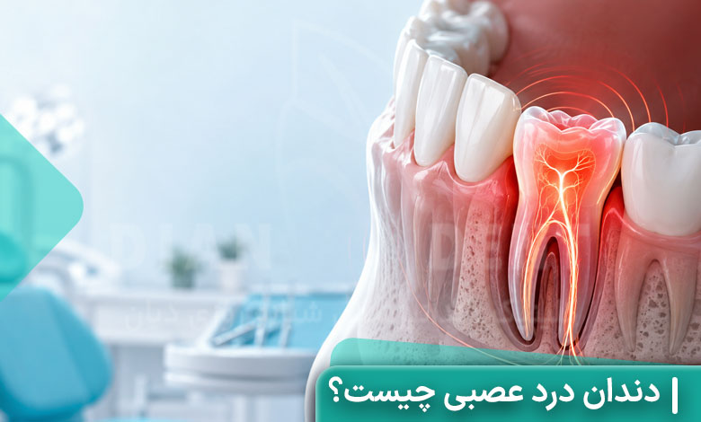 دندان درد عصبی