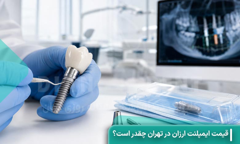 قیمت ایمپلنت ارزان در تهران