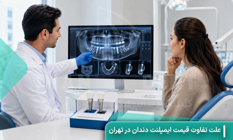 علت تفاوت قیمت ایمپلنت دندان در تهران