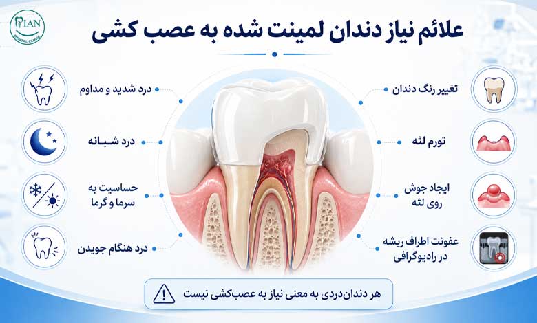 علائمی که نشان میدهد دندان لمینت شده نیاز به عصب کشی دارد