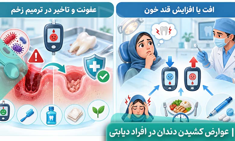 کشیدن دندان در افراد دیابتی چه عوارضی دارد؟