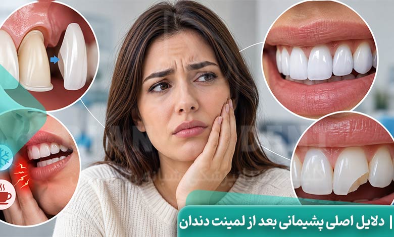 دلایل اصلی پشیمانی بعد از لمینت دندان